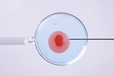 Leczenie metodą in vitro – co warto wiedzieć?