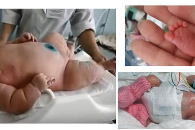 Waga niemowlaka czyli największe i najmniejsze noworodki w historii!