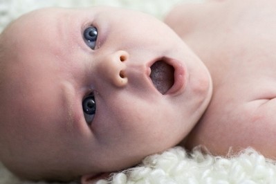 Zez u noworodka: przyczyny zezowania i kiedy jest konieczne leczenie zeza u dzieci 