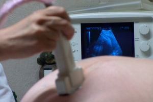 Rutynowe badania w ciąży