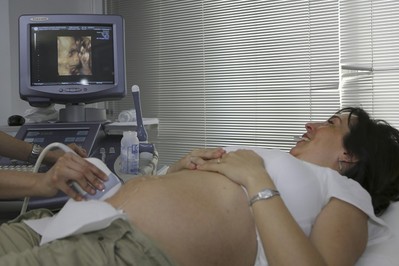 Czy USG w ciąży jest bezpieczne dla płodu i matki?