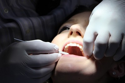Plombowanie zębów: wymień czarne wypełnienia na nowoczesne kompozytowe!