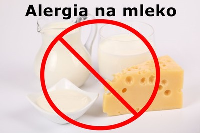 Alergia na mleko u dzieci i niemowląt – objawy i leczenie