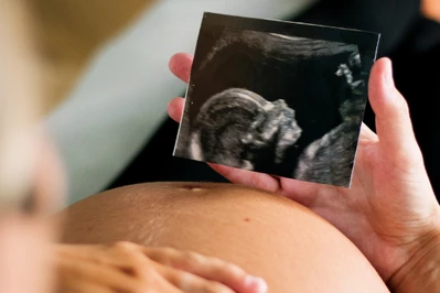 Por&oacute;d naturalny, znieczulenie - zasady w 2026 roku