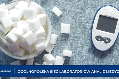 Na czym polega badanie glukozy i dlaczego jest ważne w profilaktyce zdrowia?