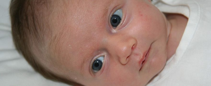 Trądzik niemowlęcy – skąd się bierze i jak go leczyć?