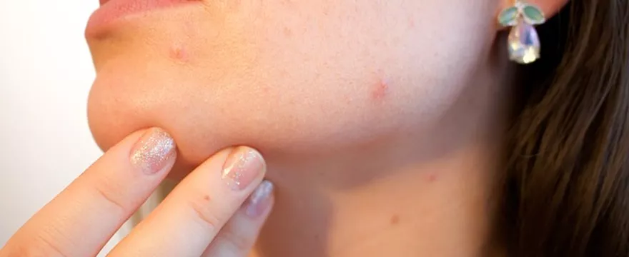 Jak usunąć drobne krostki z twarzy?