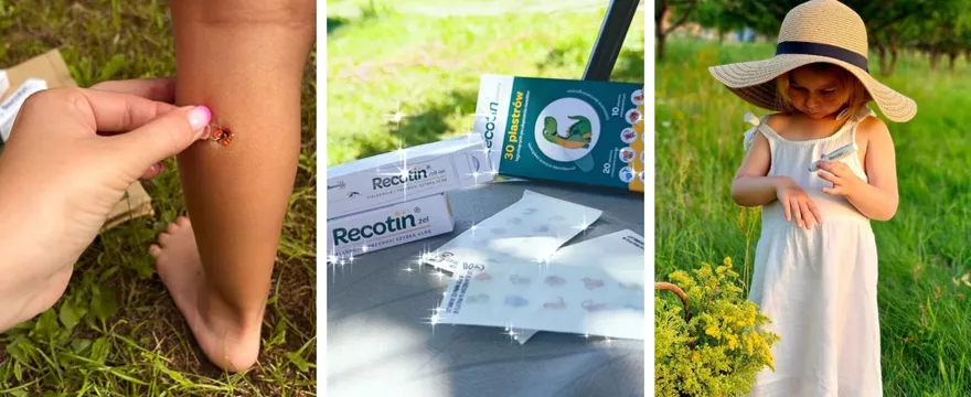 Co przynosi ukojenie po kontakcie z owadami? Mamy polecają Recotin!