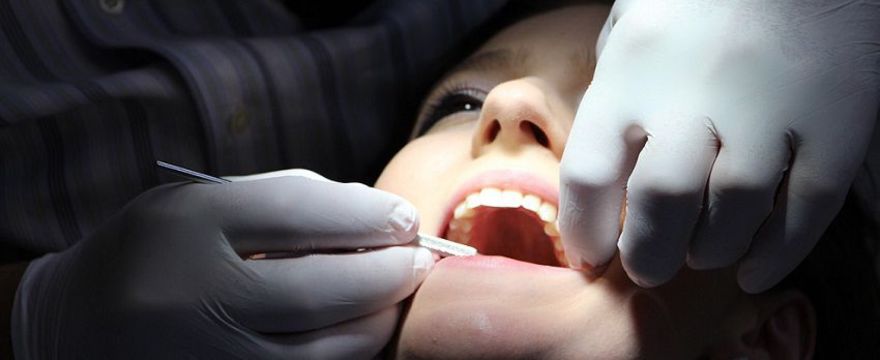 Plombowanie zębów: wymień czarne wypełnienia na nowoczesne kompozytowe!