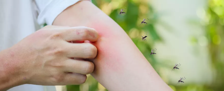 Dlaczego Ciebie komary lubią bardziej niż innych? 5 powodów